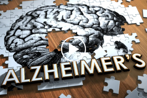 LMU 330 – Huperzine A Improves Memory and Cognition in Early-stage Alzheimer’s disease and Shows Promise of Prevention